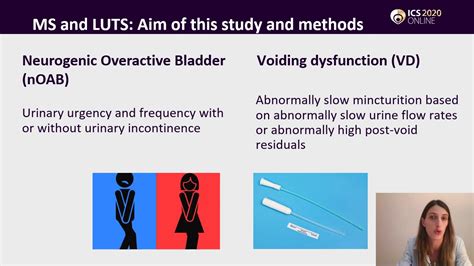 332 Prevalence Of Neurogenic Overactive Bladder And Voiding Dysfunction In Multiple Sclerosis P