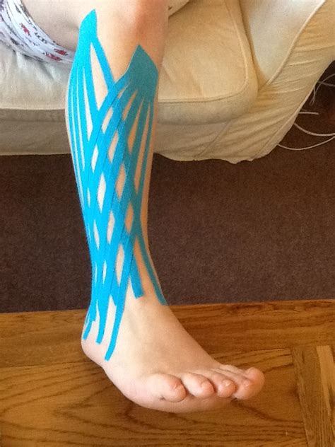 Kinesio Tape Ankle Kinesiotaping For Lymphatic Drainage Never Thought