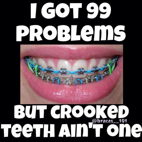 15 top brace face meme jokes images and pictures quotesbae