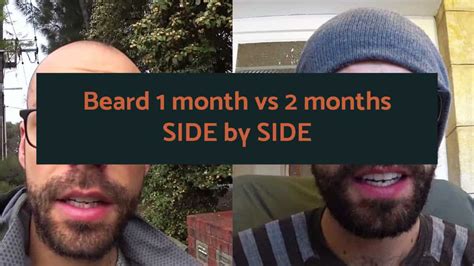 Beard Month Vs Months Side By Side Comparison