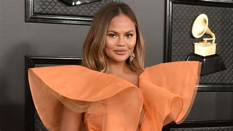 Chrissy Teigen Poses Topless Showing Surgery Scars In Body Positive Post
