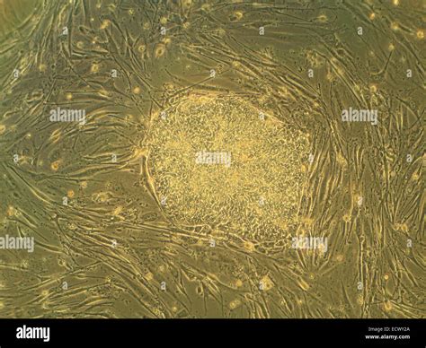 Human Embryonic Stem Cell Colony Stock Photo Alamy