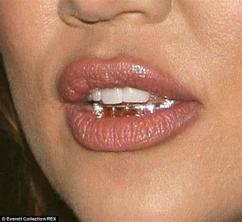 All Bite On The Night Khloe Kardashian Sports A Fuller Pout With Hip