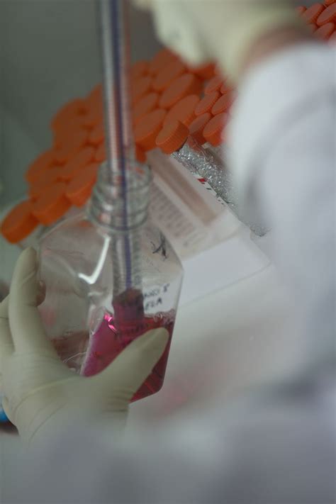 Human Primary Sebocyte Assay For Compound Testing On Lipid Metabolism