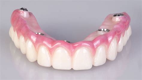 Prótese Dentária Protocolo Conheça Os Tipos E Materiais Mais Utilizados