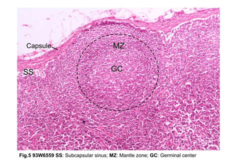 Block2fig5 Photomicrograph Of A Lymphatic Nodule