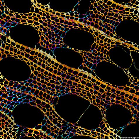 10 Average Things That Are Incredibly Beautiful Under A Microscope 12
