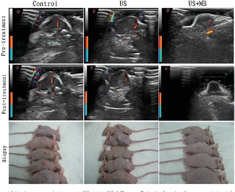 Figure 1 From Inhibitory Effects Of Subcutaneous Tumors In Nude Mice