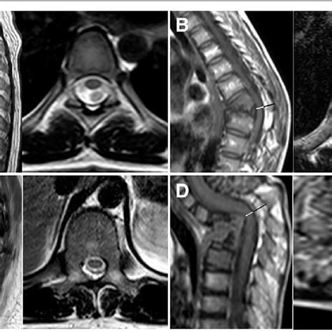Sagittal And Axial Mr Images Of Four Different Individuals Included In