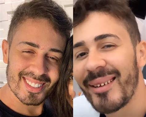 We did not find results for: Carlinhos Maia surpreende ao mostrar o sorriso natural