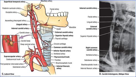 Firstly, any conditions which increase your risk of narrowing the artery need to be addressed. Pin on GROSS ANATOMY