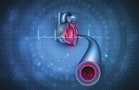 Subclinical Cardiovascular Disease Similar Despite Hiv Stratified