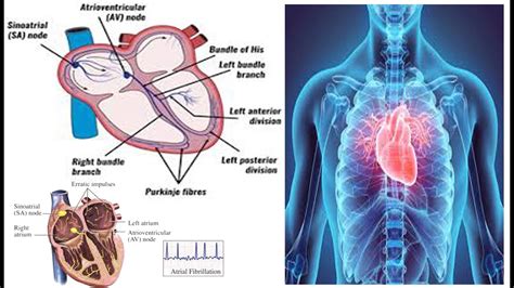 heart palpitations information about irregular heartbeat youtube