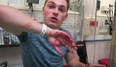 Bungling Youtube Star Slices Through Own Finger As Fruit Ninja Sword Trick Goes Horribly Wrong