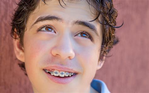 a guide to getting braces just on your bottom or top teeth orthodontist
