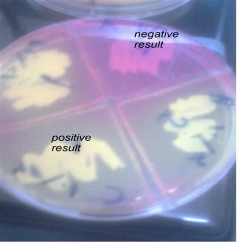 3 Mannitol Salt Agar Plate Showed Negative And Positive Result For