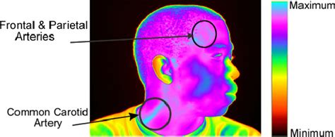 Visualization Of The Temperature Values Of A Thermal Facial Image The