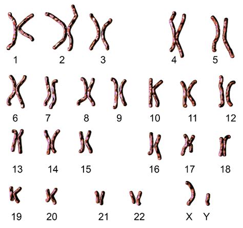 Lista 105 Foto Tipos De Cromosomas Según La Posición Del Centrómero