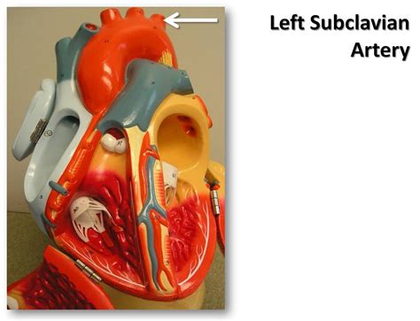 Left Subclavian Artery Anterior View The Anatomy Of The Flickr