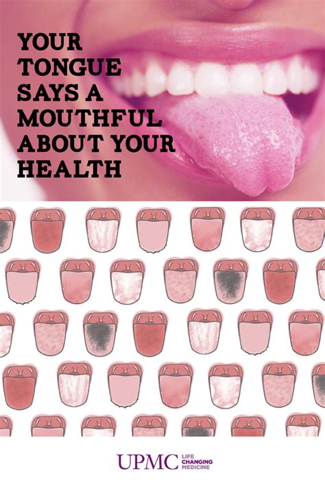 What Does Your Tongue Say About Your Health Infographic Upmc Tongue