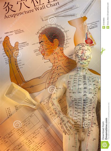 Traditional Chinese Acupuncture Editorial Image Image Of Model Life 31504850