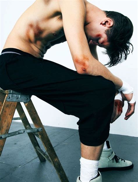 Eli Hall Is Battered And Bruised For Creem Magazine Bruises Aesthetic