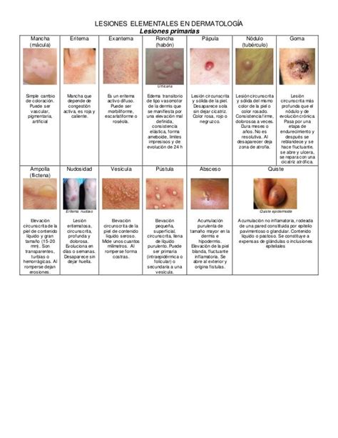 Lesiones Elementales En Dermatología Medicine Med Reminder