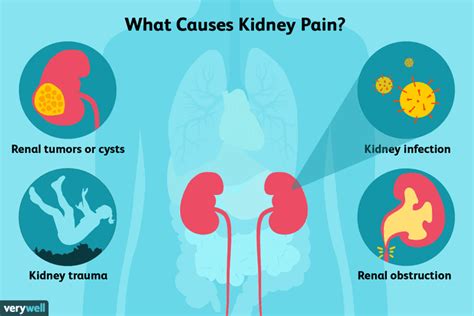Acute Kidney Pain Is It A Stone Pedmore Medical