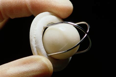 Artificial Heart Valve Photograph By Steve Allenscience Photo Library