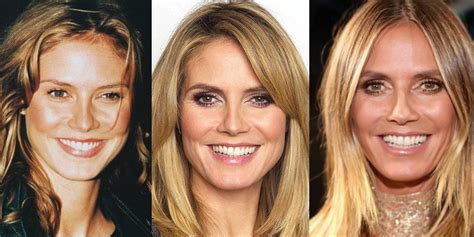 Heidi Klum Plastic Surgery Before And After Pictures 2020
