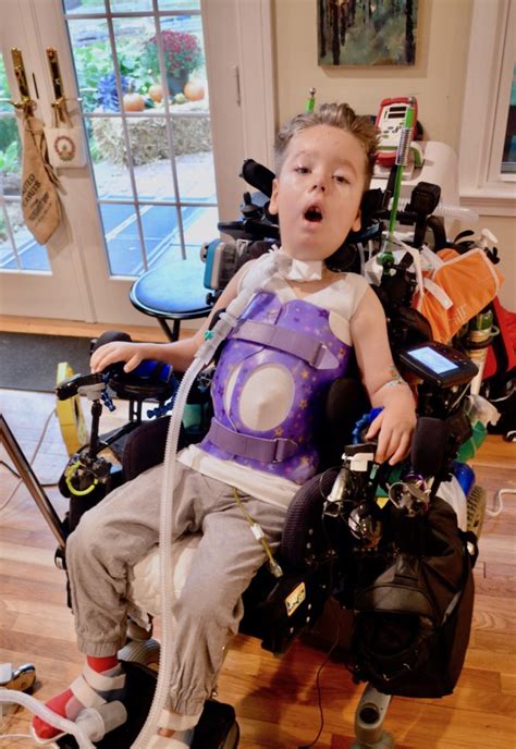 How Bracing Can Help Childhood Spinal Muscular Atrophy National