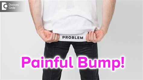 Painful Bump On Buttocks Causes Symptoms And Treatment Dr Rajdeep