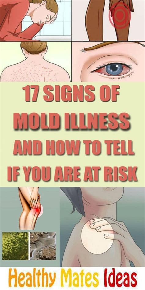 17 Signs Of Mold Illness And How To Tell If Youre At Risk Fitness