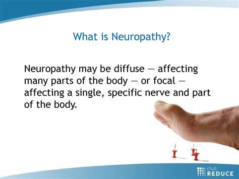 Implementing The New Np Neuropathy Kit With New Patients Ppt Download
