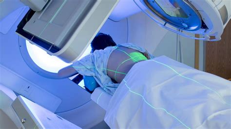 Radiotherapy Rhazes Global