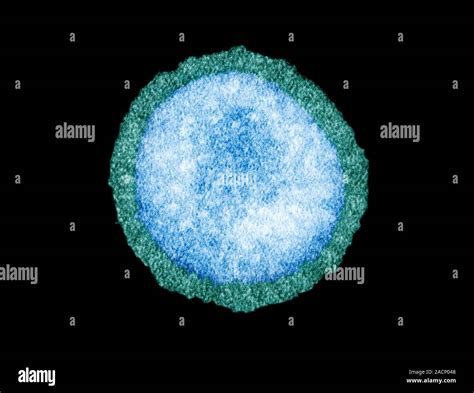 Influenza Virus Particle Coloured Transmission Electron Micrograph