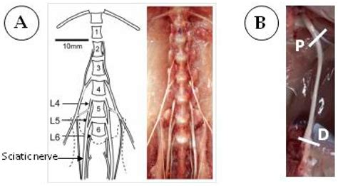 Cells Free Full Text Assessing Autophagy In Sciatic Nerves Of A Rat Model That Develops