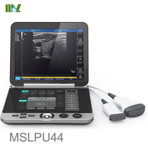 Portable Ultrasound Machine Mindray Dp 10