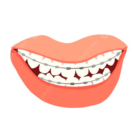 Oral Orthodontic Flat Outline Vector Teeth Braces Png