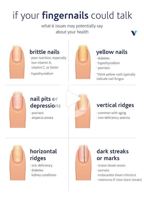 Nail Ridges With Thyroid Disease Nailsr