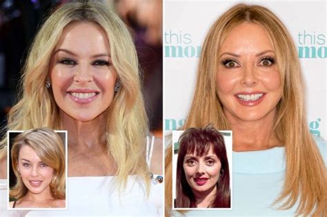 50 Celebrity Plastic Surgeries Before And After Images WikiGrewal