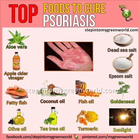 13 Best Psoriasis Images On Pinterest Natural Remedies Natural