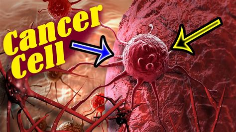 How To Cure Cancer Naturally And Effectively Youtube