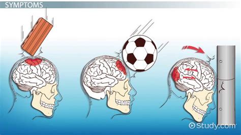 Blunt Force Trauma Definition Symptoms And Examples Video And Lesson