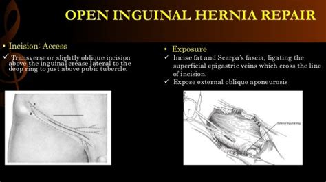 Hernia Inguinal Lateral