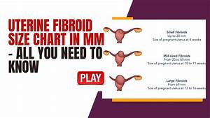Full Uterine Fibroid Size Chart In Mm Youtube