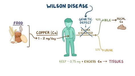 Wilson Disease Video Anatomy Definition And Function Osmosis