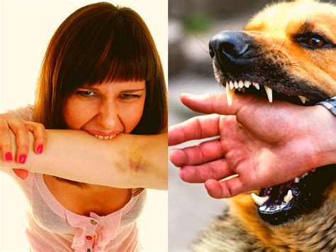 Top 109 Worst Animal Bites