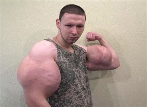 Man Injected Oil Into His Biceps He Fears Losing Arms Afrinik