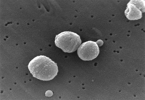 Streptococcus Pneumoniae Définition Et Explications